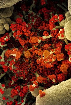 An apoptotic cell (tan) heavily infected with novel coronavirus particles (orange), isolated from a patient sample and viewed through a scanning electron micrograph.