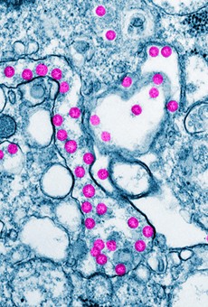 Viral particles are colorized purple in this color-enhanced transmission electron micrograph from a COVID-19 patient in the United States. Computer modeling can help epidemiologists predict how and where the illness will move next.